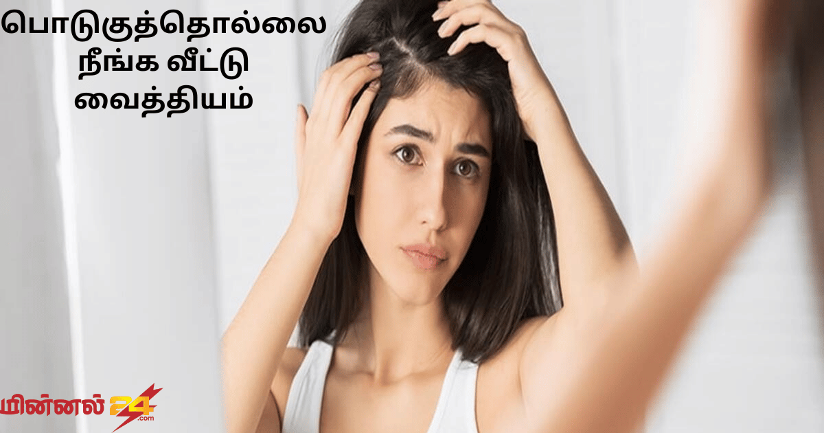 பொடுகுத்தொல்லை நீங்க வீட்டு வைத்தியம்