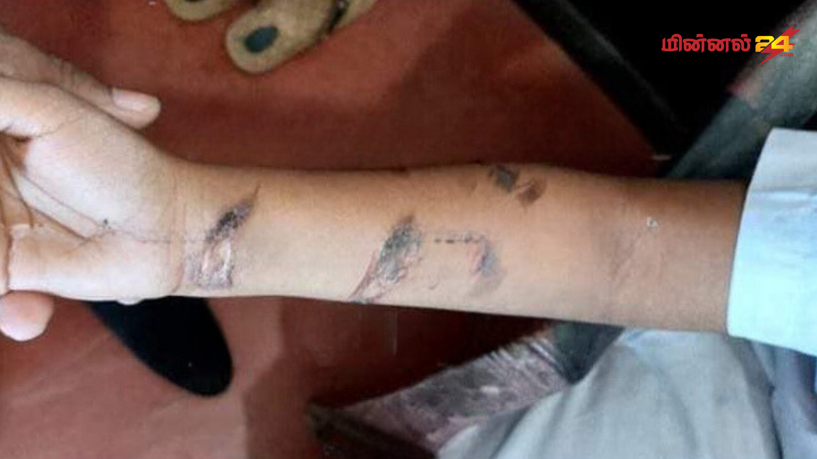 100 ரூபாவுக்காக தந்தையின் கொடூரச்செயல்