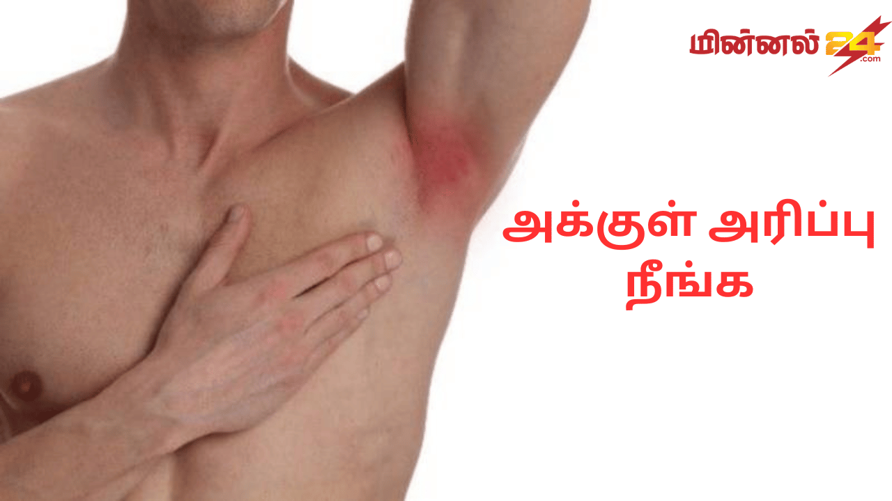 அக்குள் அரிப்பு நீங்க