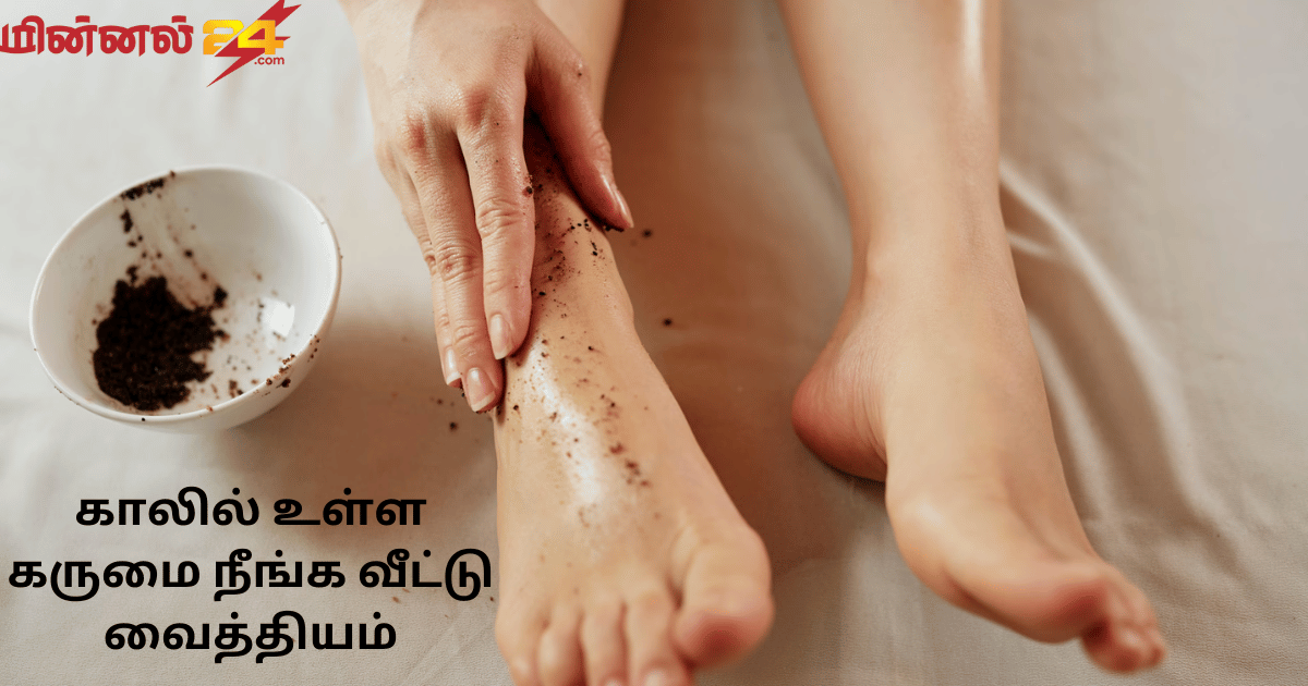 காலில் உள்ள கருமை நீங்க வீட்டு வைத்தியம்