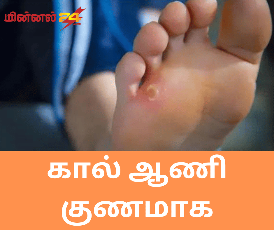 கால் ஆணி குணமாக