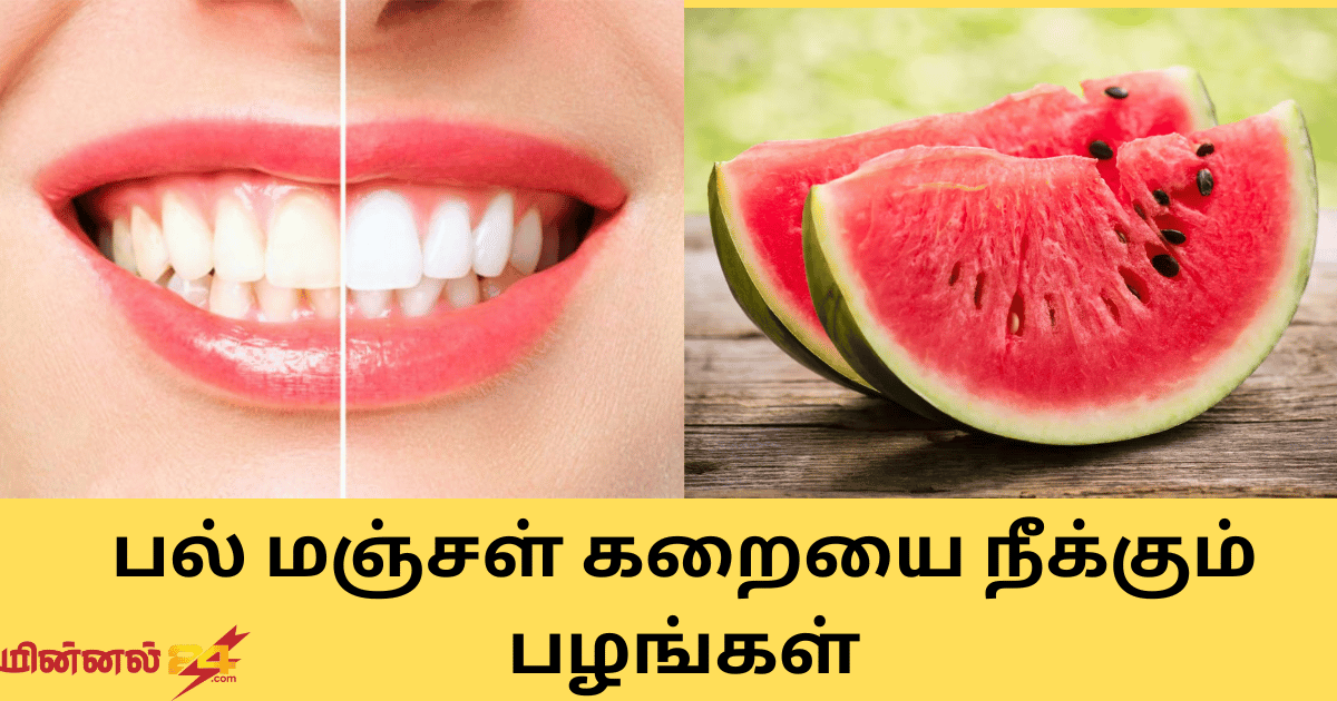 பல் மஞ்சள் கறையை நீக்கும் பழங்கள்
