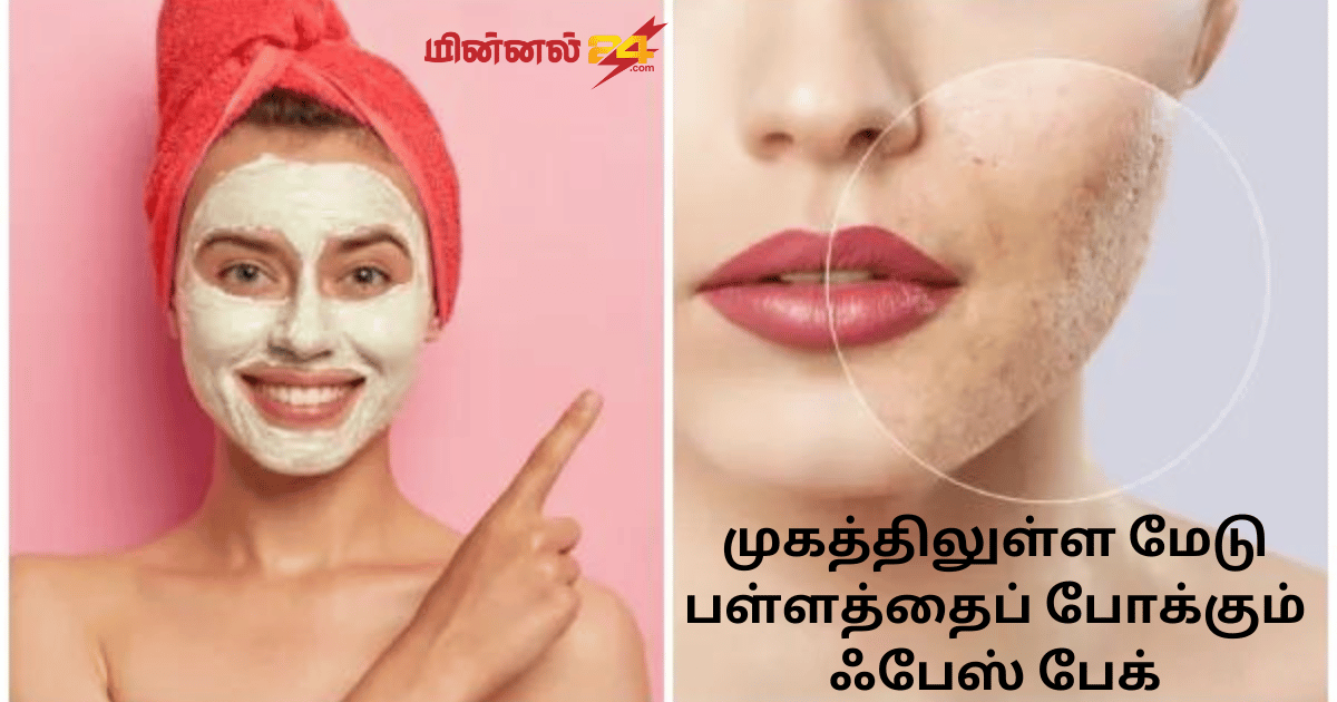 முகத்திலுள்ள மேடு பள்ளத்தைப் போக்கும் ஃபேஸ் பேக்