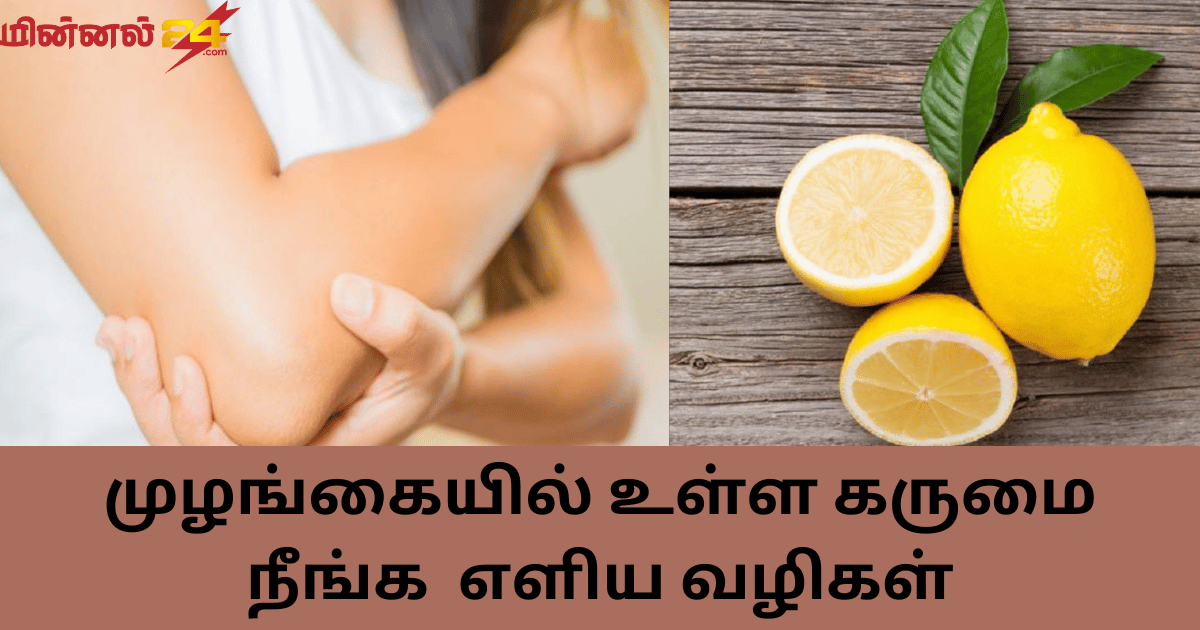 முழங்கையில் உள்ள கருமை நீங்க எளிய வழிகள்
