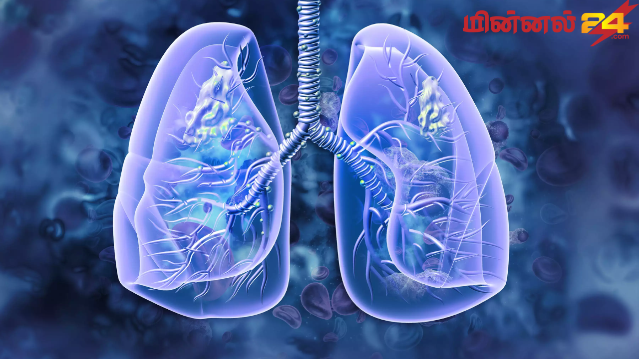 உலகளாவிய காச நோய் தினம் (World Tuberculosis Day)