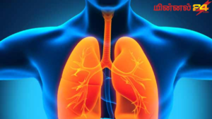 உலகளாவிய காச நோய் தினம் (World Tuberculosis Day)