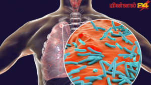 உலகளாவிய காச நோய் தினம் (World Tuberculosis Day)