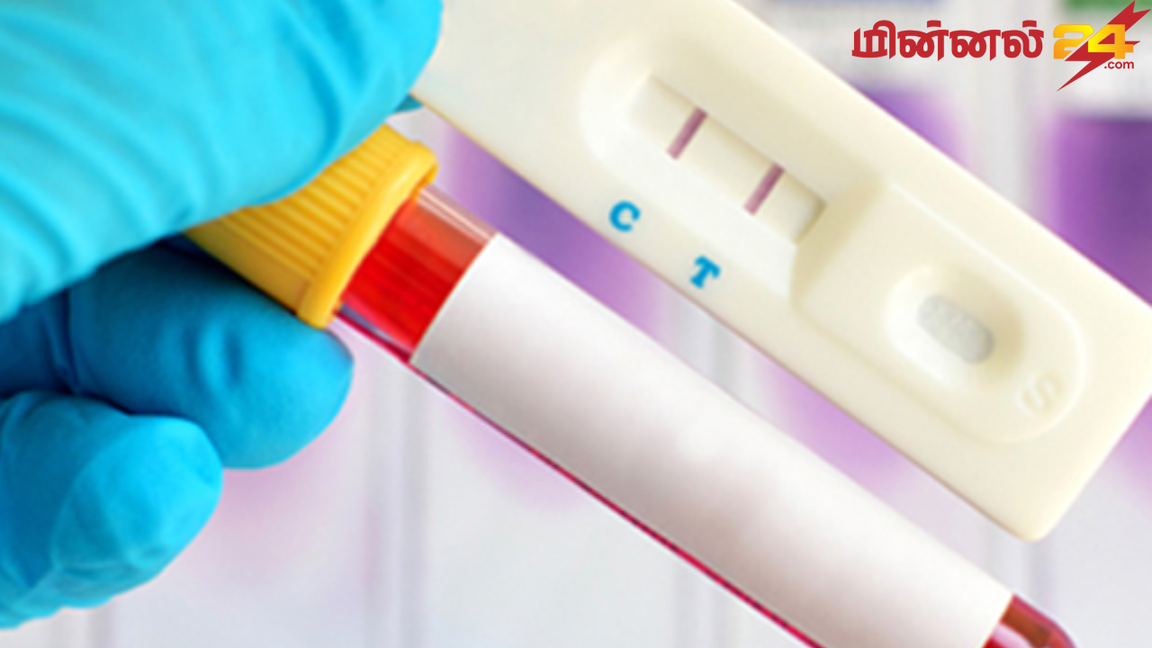 இலங்கையில் வரலாறு காணாத அளவுக்கு அதிகரித்துள்ள எச்.ஐ.வி தொற்று