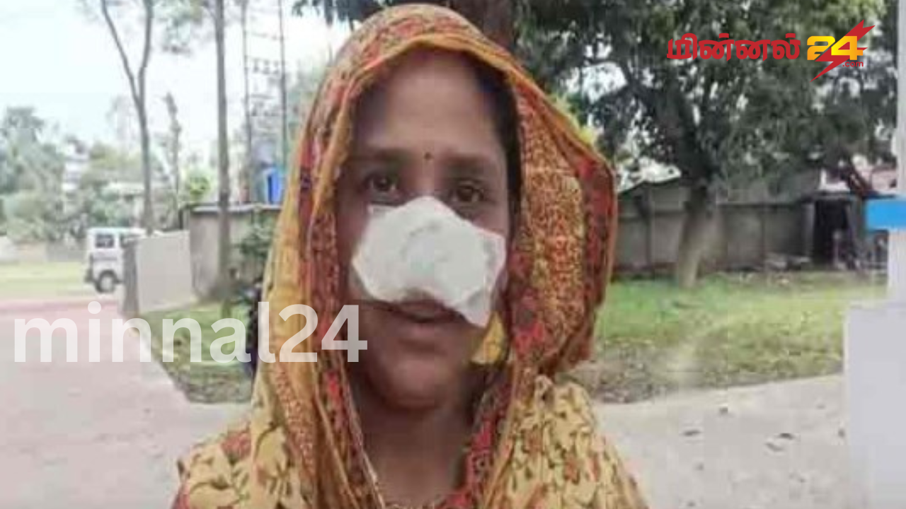 மனைவியின் மூக்கு அழகாக இருந்ததால் அதை கடித்து ருசி பார்த்த கணவன்