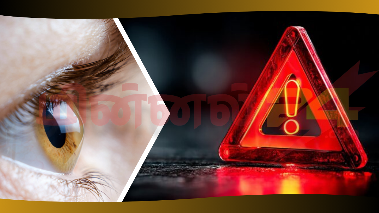 கண்ணில் ஏற்படும் கெரடோகோனஸ் தொற்று