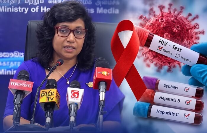 இலங்கையில் ஆண்களுக்கிடையில் எச்.ஐ.வி தொற்று அதிகரிப்பு